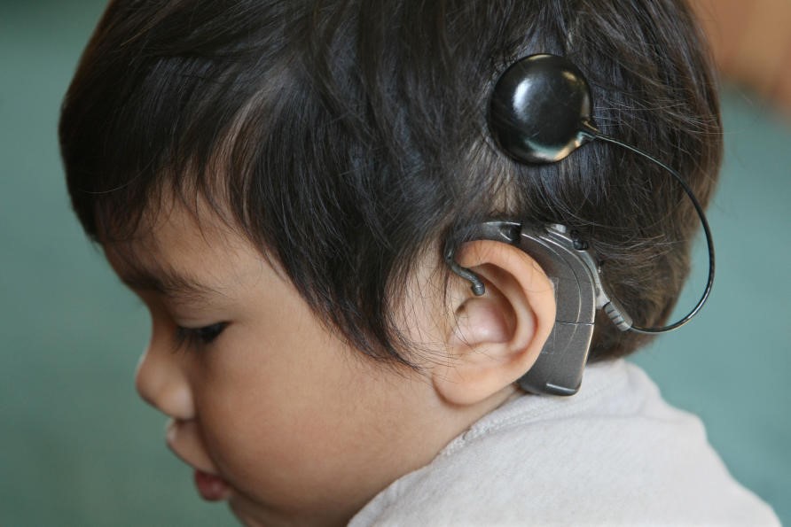 Photograph: A child with a cochlear implant.